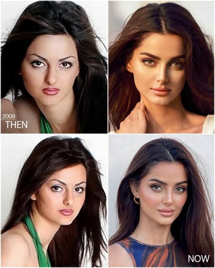 Aishwarya Rai's Journey Through Face Surgery: A Glimpse into Transformation