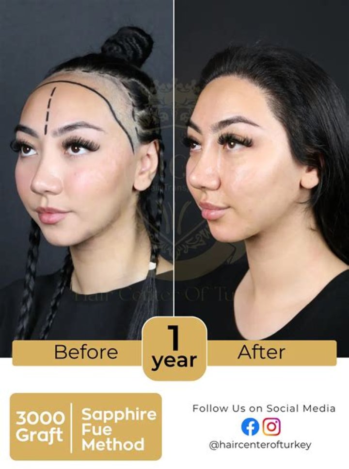 Before and After Nudes: Transformations that Inspire