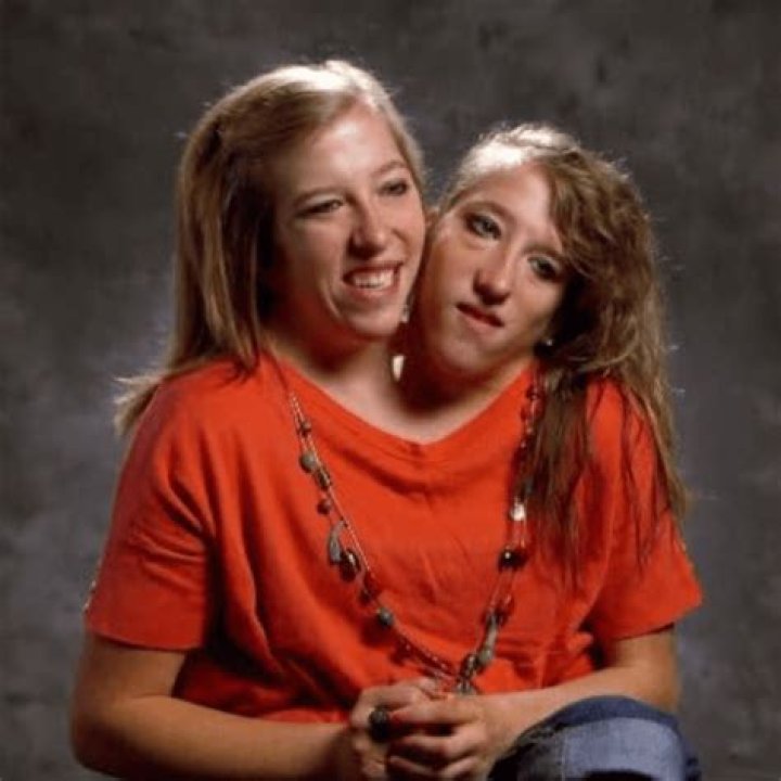 Conjoined Twins Abby and Brittany Hensel Tie the Knot