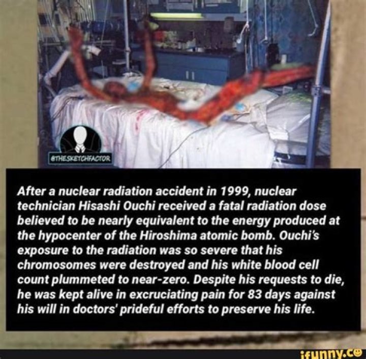 Hisashi Ouchi's Skin: A Case Study of Radiation-Induced Injuries