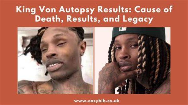 King Von Autopsy: Cause of Death Explained