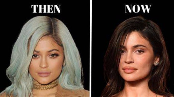Kylie Jenner Before Plastic Surgery: A Closer Look at Her Transformation