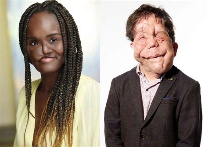 Neil Pearson: A Journey Through the Life of a Versatile Actor
