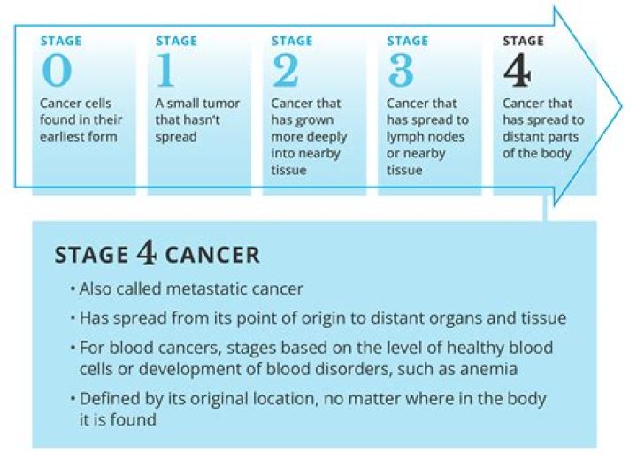 Pioneering Strength: The Journey of a Woman Battling Stage 4 Colon Cancer