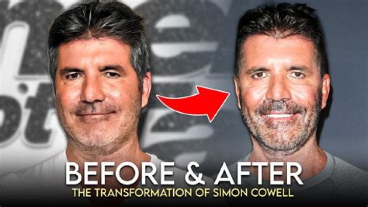 Simon Cowell Before and After: A Comprehensive Transformation Journey