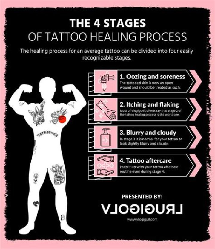 Tattoo Peeling: What You Need to Know for Proper Aftercare