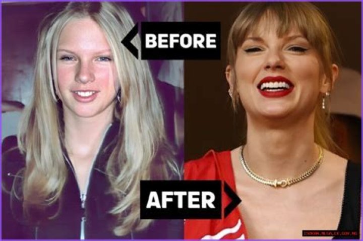 Taylor Swift's Breast Implants: A Comprehensive Guide
