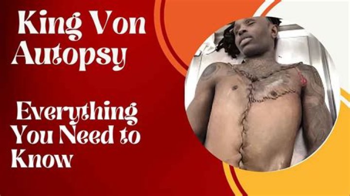 The Chilling Details: King Von's Autopsy Report Released for Public Scrutiny