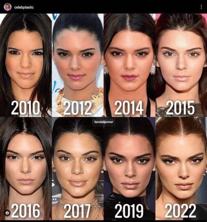 The Transformation of the Kardashians: Before and After