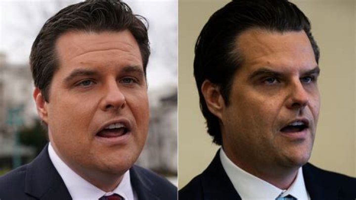 The Unseen Truth About Matt Gaetz's Plastic Surgery Transformation