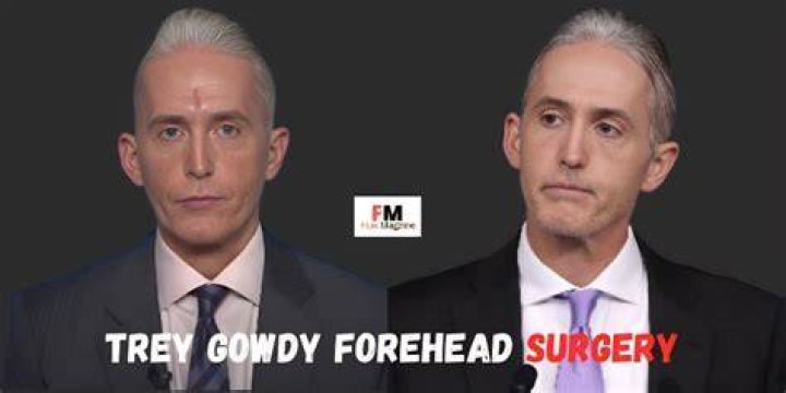 Trey Gowdy Forehead Surgery: Unveiling the Truth Behind His Transformation