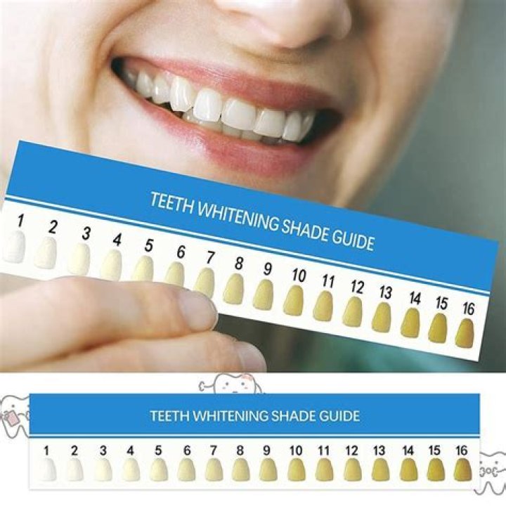 Ultimate Guide to Teeth Whitening with White Strips: Your Path to a Brighter Smile