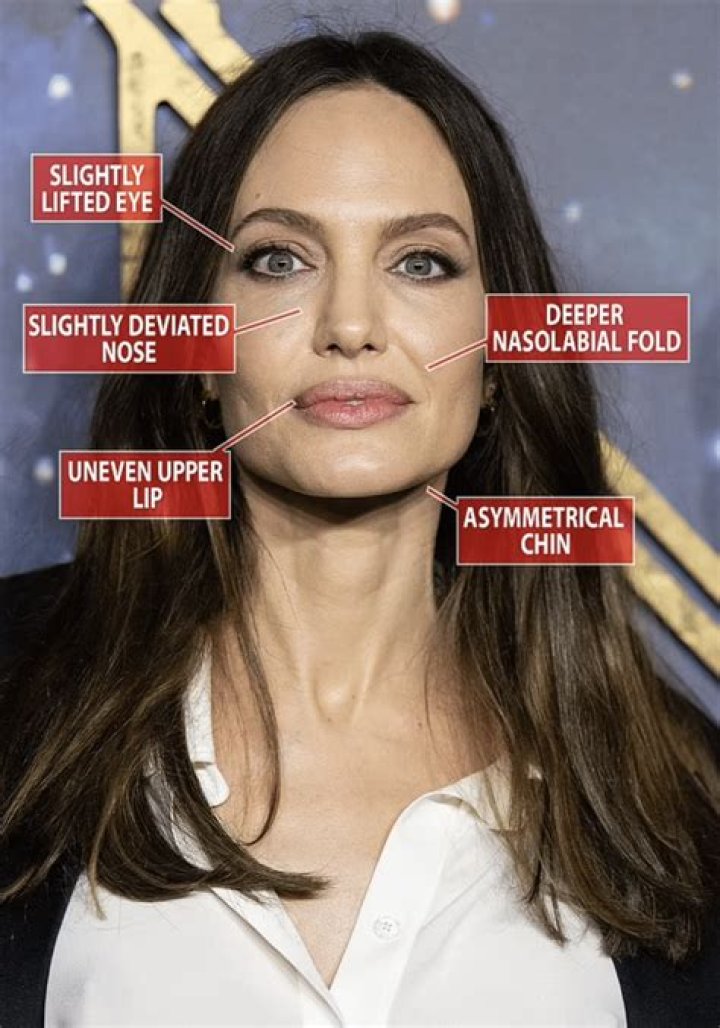 Unevenly Beautiful: Celebrities with Uneven Lips