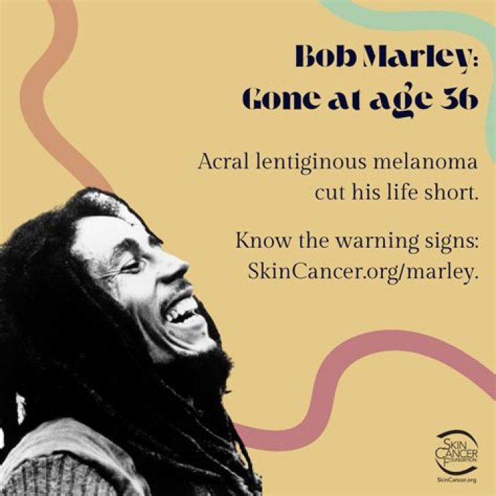 Unraveling the Mystery: Did Bob Marley Have His Toe Removed?