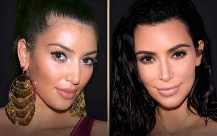 Unrecognizable: The Kardashians Before Plastic Surgery Surprises You