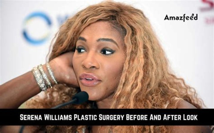 Unveiling the Truth Behind Serena Williams Plastic Surgery