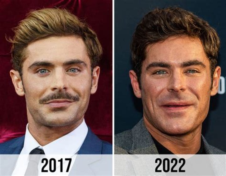 Zac Efron's Face Change: An In-Depth Look at His Transformation